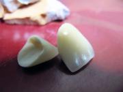 Стоматологическая клиника ДЕНТА - фото2