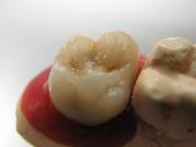 Стоматологическая клиника ДЕНТА - фото3