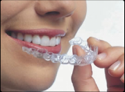 Стоматологическая клиника СКАЙСя - ортодонтия